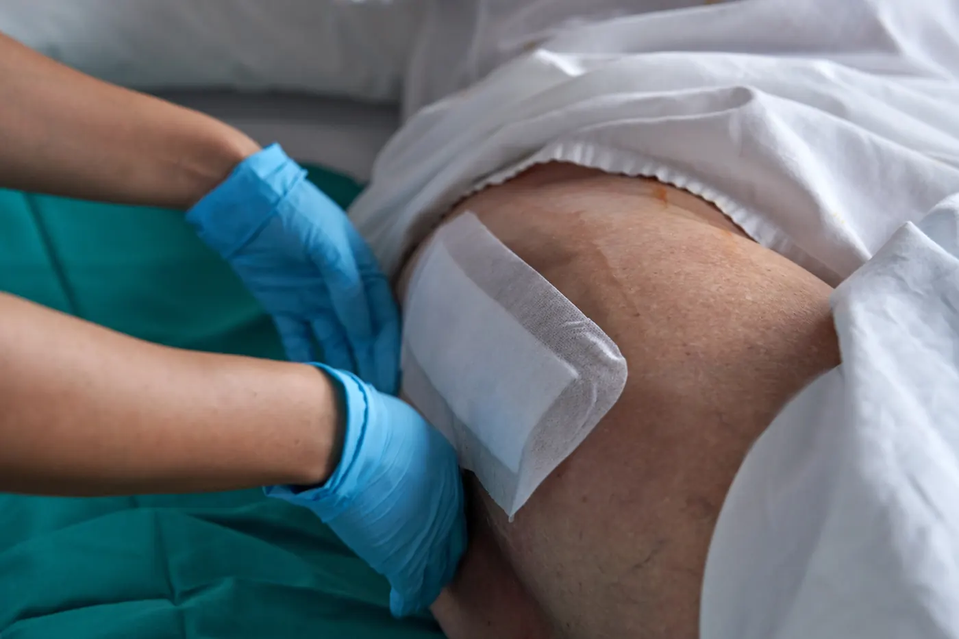 Pflegekraft mit Handschuhen versorgt eine Wunde am Bein